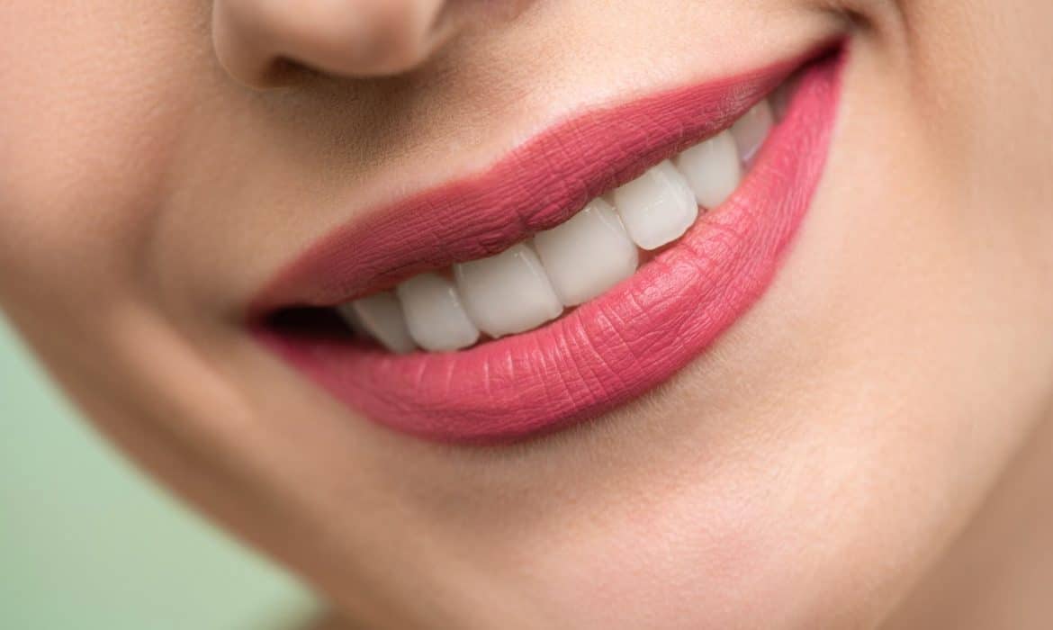 6 choses à savoir avant de se faire poser des implants dentaires