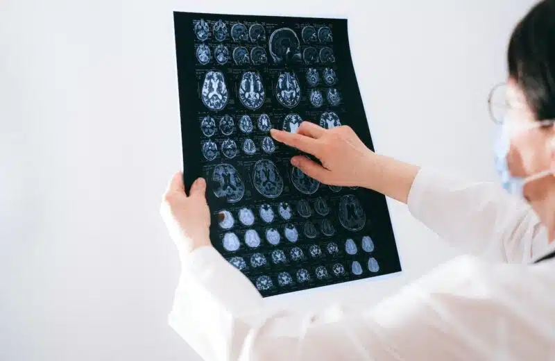 Préserver sa mémoire et stimuler son cerveau : les meilleures pratiques à adopter en vieillissant