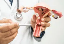 Statistiques et stades du cancer de l’endomètre
